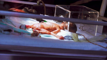 Preemie Gas Relief: What Every Parent Should Know About Gas Drops