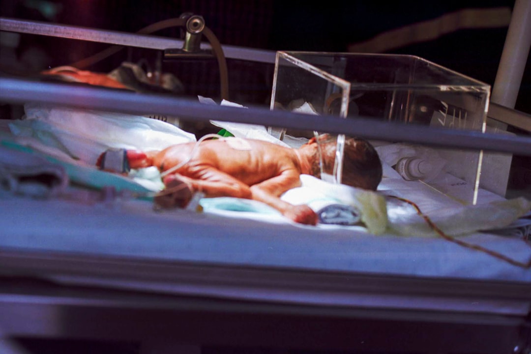 Preemie Gas Relief: What Every Parent Should Know About Gas Drops